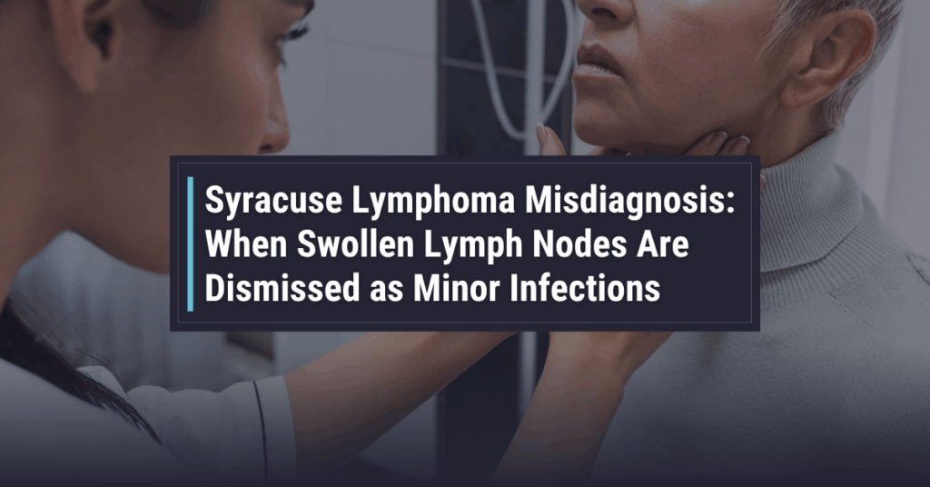 Syracuse Lymphoma Misdiagnosis: When Swollen Lymph Nodes Are Dismissed as Minor Infections | Powers & Santola, LLP 
