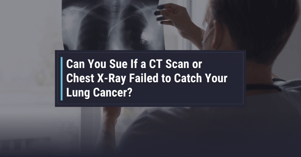 Can You Sue If a CT Scan Failed to Catch Lung Cancer
